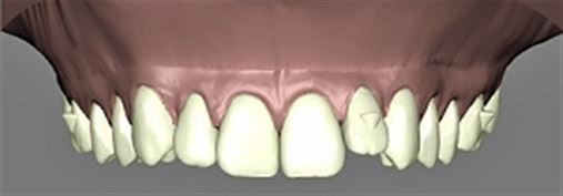 A Nova Ortodontia é estética e digital: você estará pronto, Doutor?