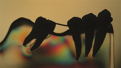 Análise fotoelástica da distribuição de tensões geradas pela mecânica de verticalização nos segundos molares inferiores