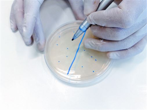 Aderência de bactérias em ligaduras ortodônticas e desinfecção com uso de colutórios