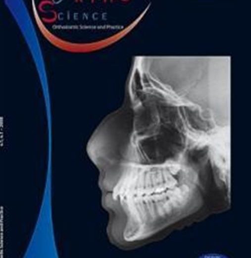 A modified Thurow maxillary splint used in the treatment of a skeletal Class II: clinical case report
