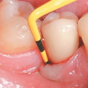 Reposicionamento mandibular em paciente com desvio funcional: relato de caso