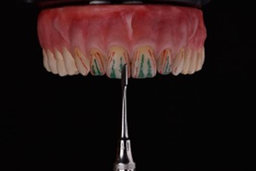 Coluna da Tininha:  A importância de determinados constituintes dentais do Incisivo central