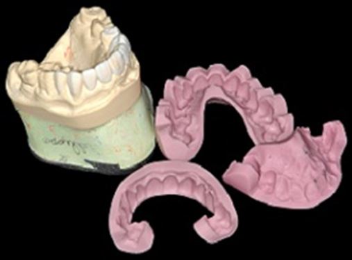 Correção estética dental associada a melhoria da autoestima em paciente idoso