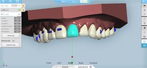 Caderno DDS-BR: Ortodontia Digital com Alinhadores Ortodônticos – Sistema Cleartek