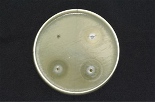 Avaliação da eficiência antibacteriana de géis e pomadas utilizados no interior de implantes