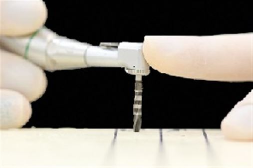 Influência das técnicas de fresagem na estabilidade primária de implantes osseointegrados – estudo in vitro
