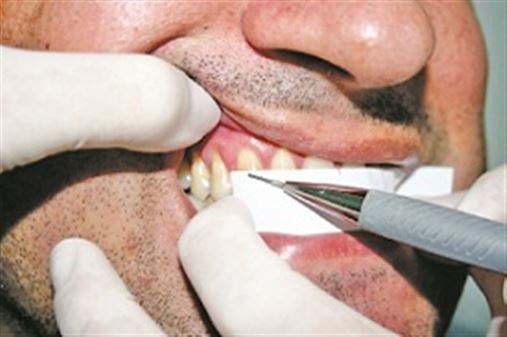 Nova técnica para a seleção da largura dos dentes anterossuperiores utilizando a proporção áurea