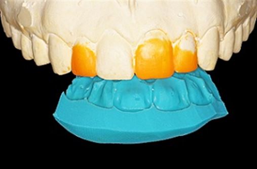 Cosmética dental anterior – relato de caso