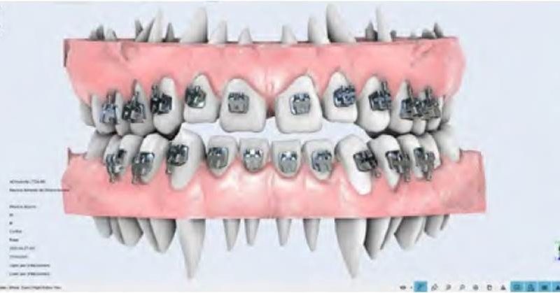 La importancia de la TI en la odontología digital