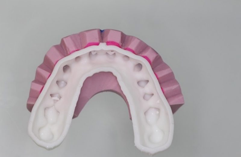 Planejamento ortodôntico digital guiado pelo sorriso – protocolo para impressão de mockup para uso clínico