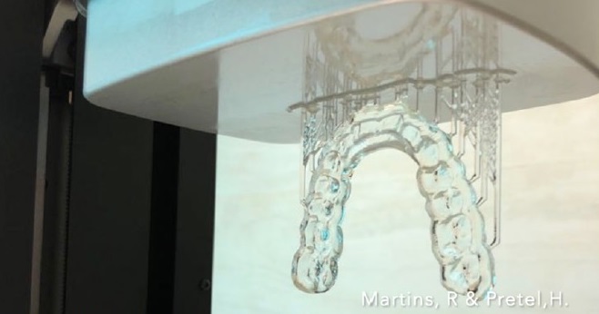 Confecção digitalizada 3D de placas oclusais