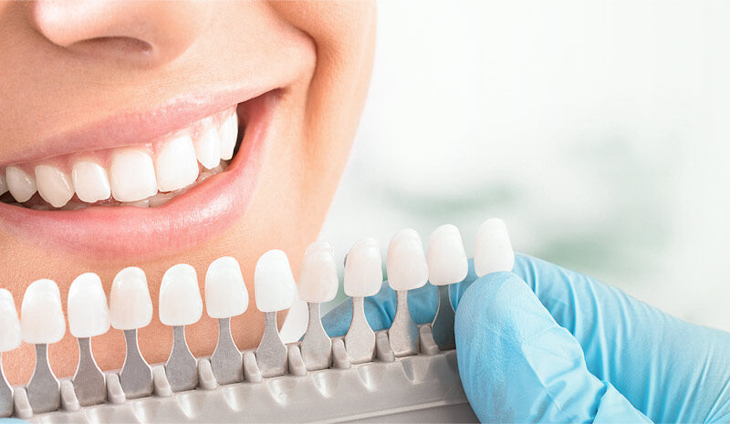 Odontologia Estética cresceu mais de 560% em 2021