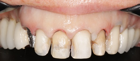 Tratamento Orofacial – o passo a passo da Odontologia Contemporânea